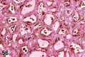 Figure 56.