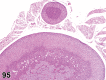 Figure 95.