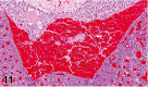 Figure 11.