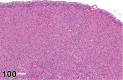 Figure 100.