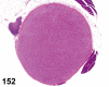 Figure 152.
