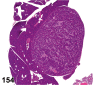 Figure 154.