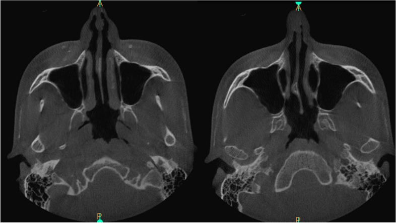 Fig. 7