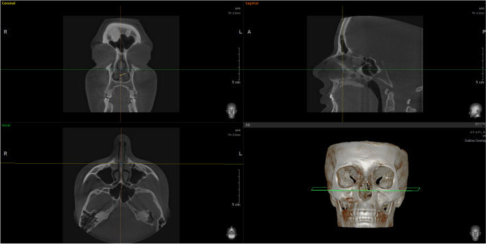 Fig. 8