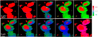 Figure 21