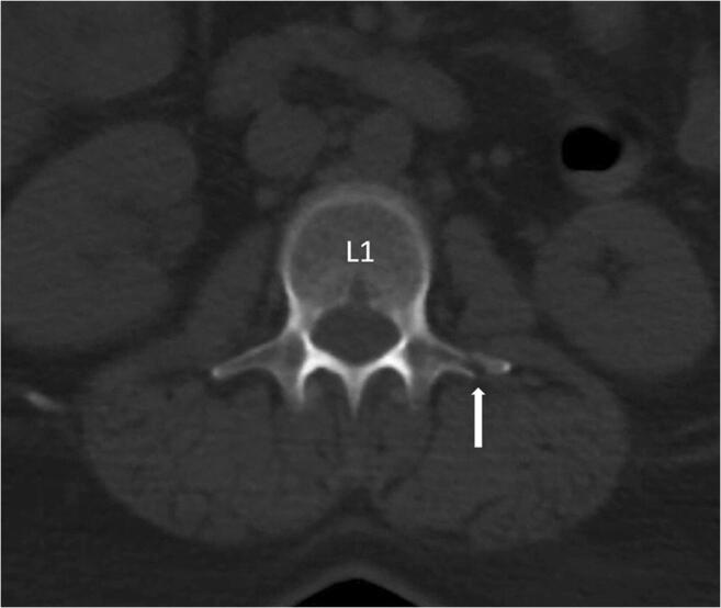 Fig. 2