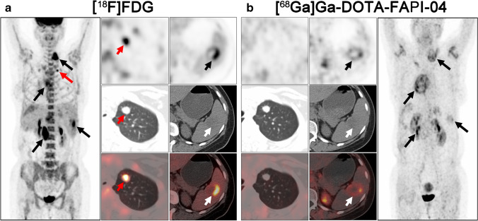 Fig. 6