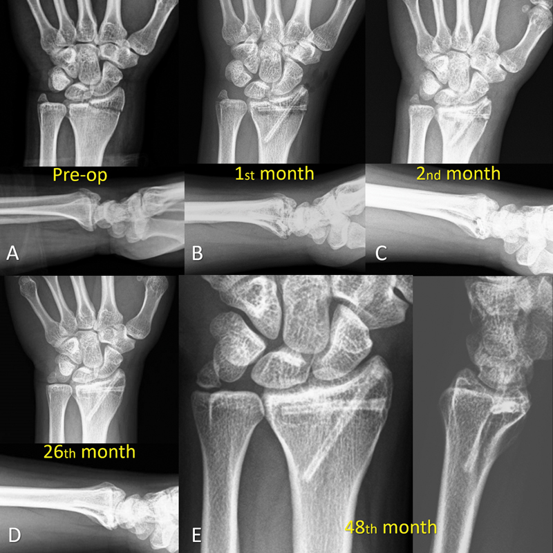 Fig. 1