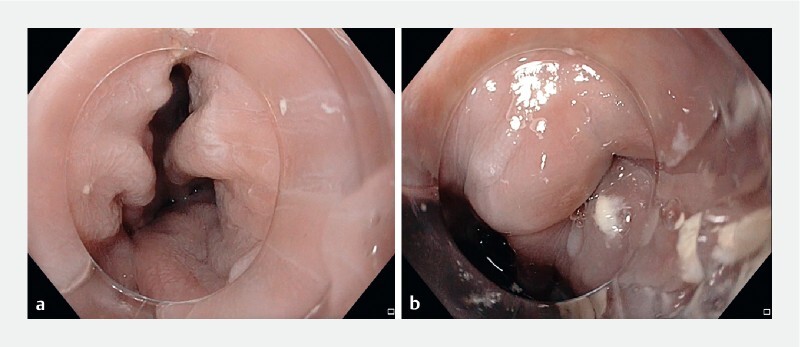 Fig. 2