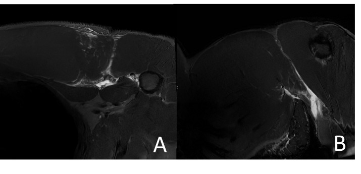 A close-up of a mri Description automatically generated