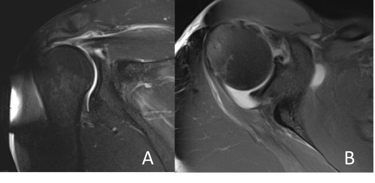 A close-up of a mri scan Description automatically generated