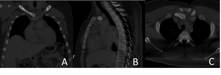 A close-up of an x-ray Description automatically generated