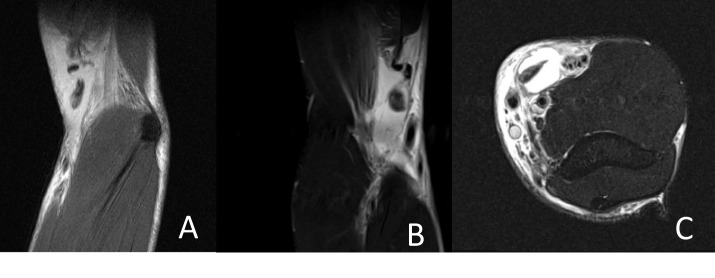 A close-up of a mri scan Description automatically generated