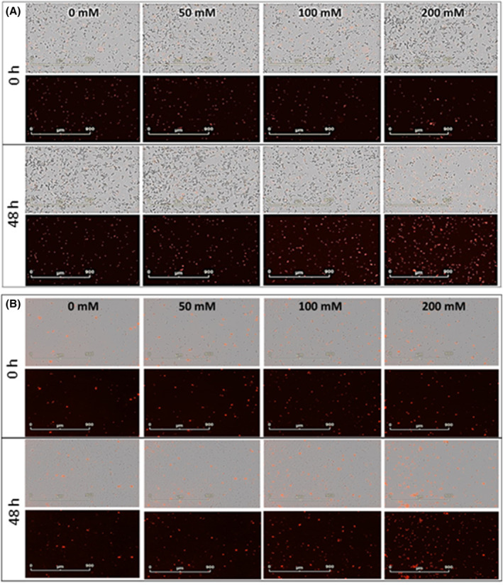 FIGURE 4