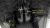 Fig 7