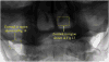 Fig 12