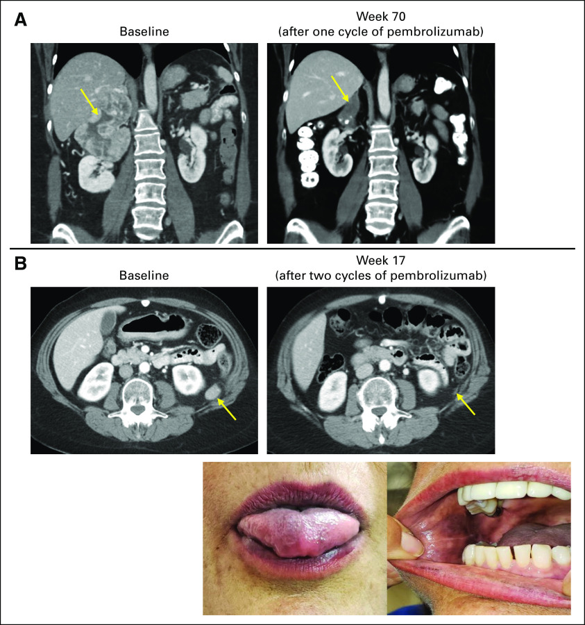 FIG 2.