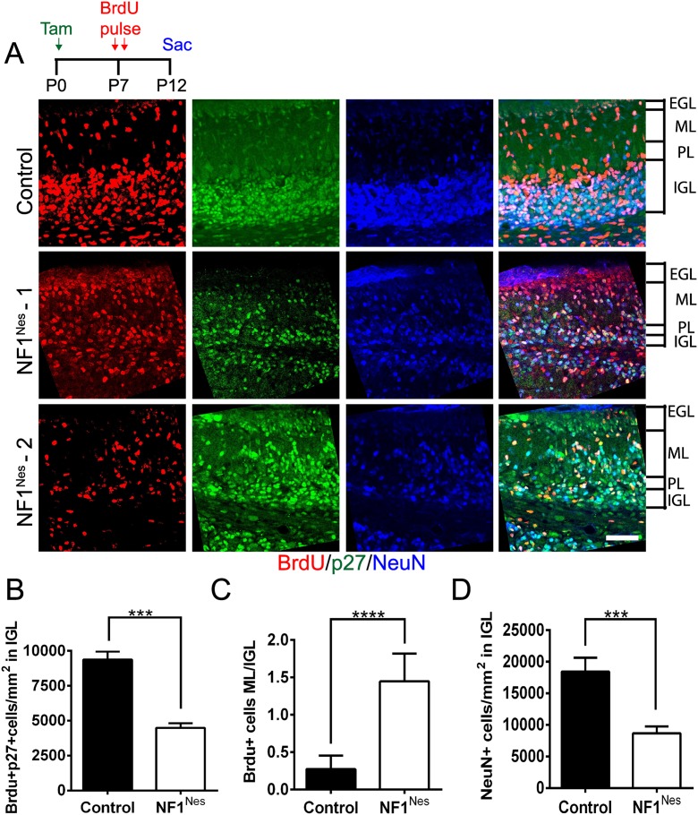 NF1 regulation of RAS/ERK signaling is required for appropriate granule ...