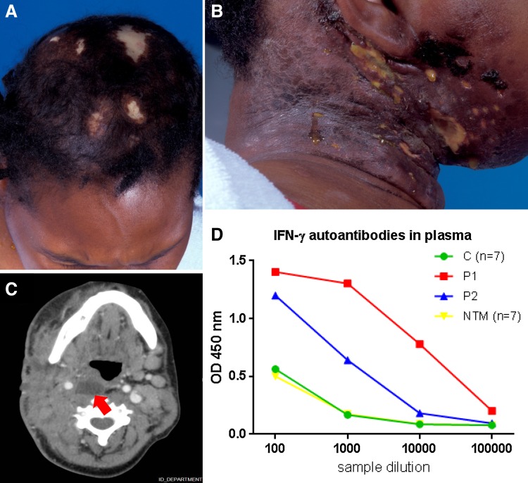 Fig. 1