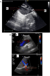 Fig. 3