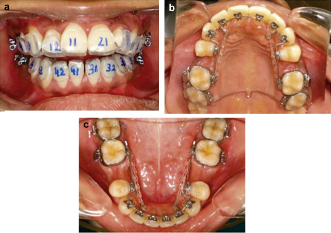 Fig. 3