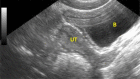 Fig. 3