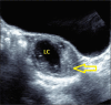 Fig. 16