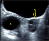 Fig. 14