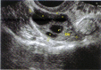 Fig. 6
