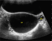Fig. 18