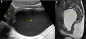Fig. 11