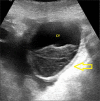 Fig. 17