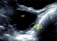 Fig. 15