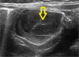 Fig. 13