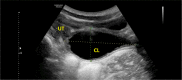 Fig. 12