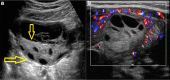 Fig. 19