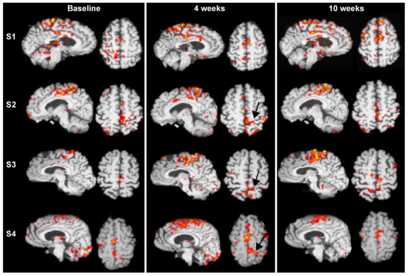 Fig. 3