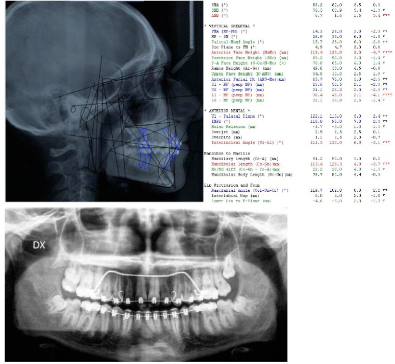 Fig. (11)