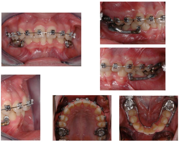 Fig. (6)