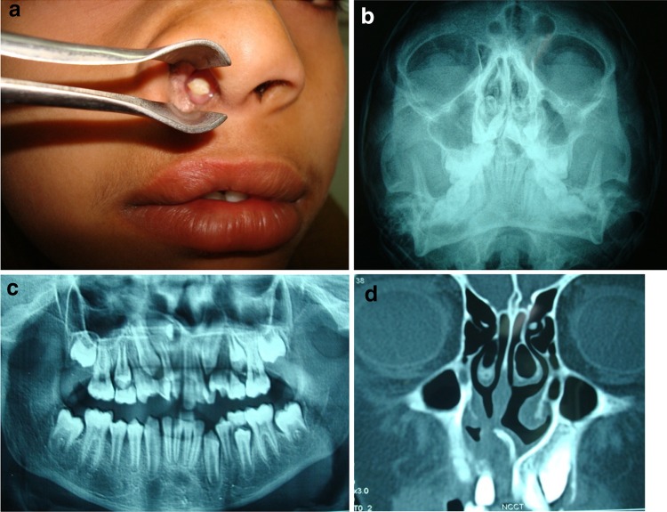 Fig. 1