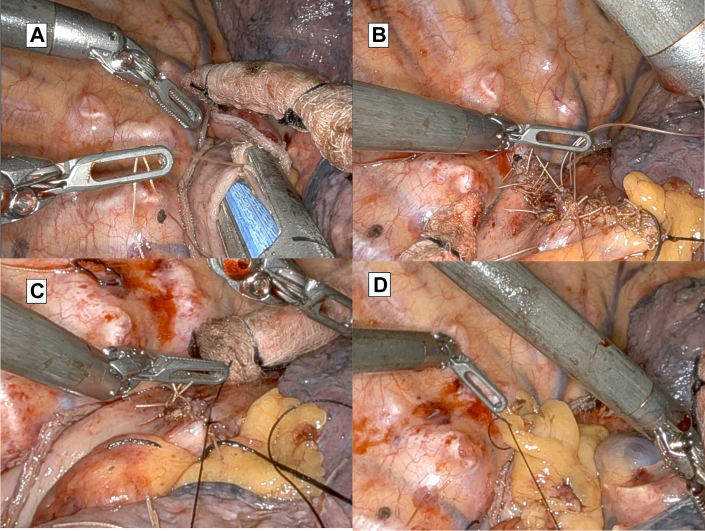 Figure 2