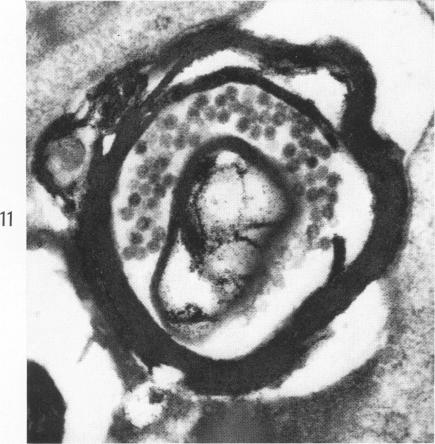 Fig. 11