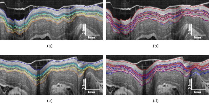 Fig. 10