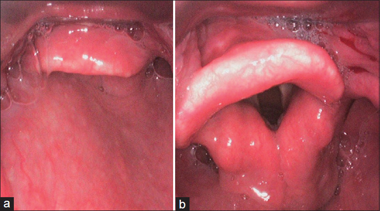 Figure 1: