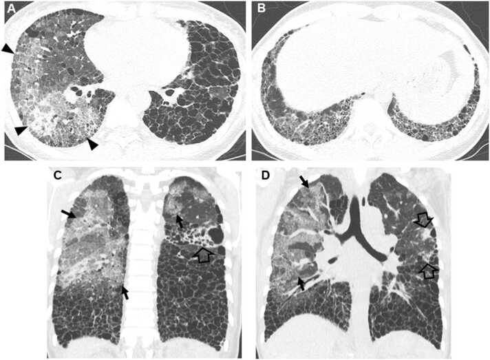 Fig. 9