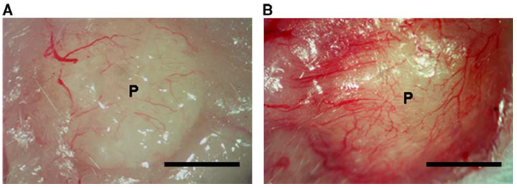 FIG. 6