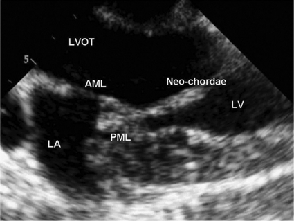 Figure 3: