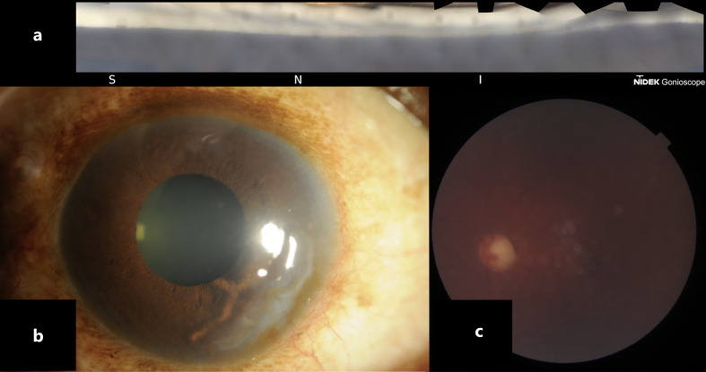 Fig. 2.