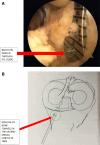 Fig 4