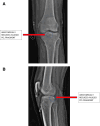 Fig 8